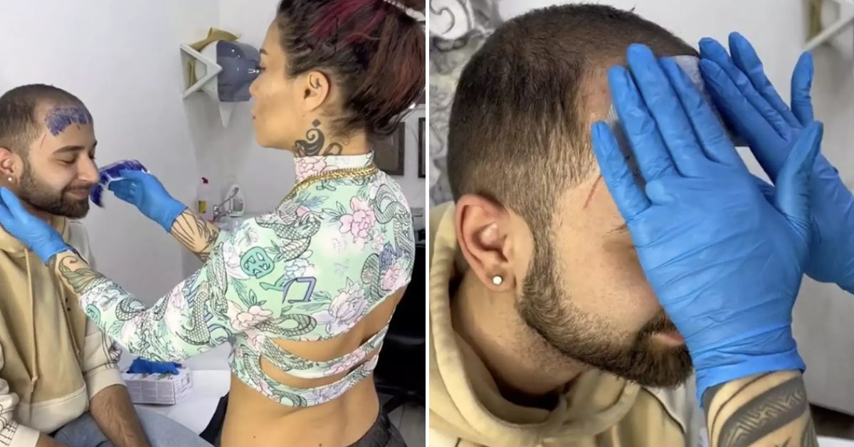 [VÍDEO] Homem decide tatuar franja na testa após começar a ficar calvo aos 26 anos e chora ao ver resultado