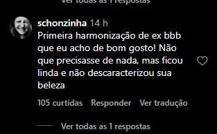 Fãs elogiam harmonização facial de Deniziane - Foto: Instagram