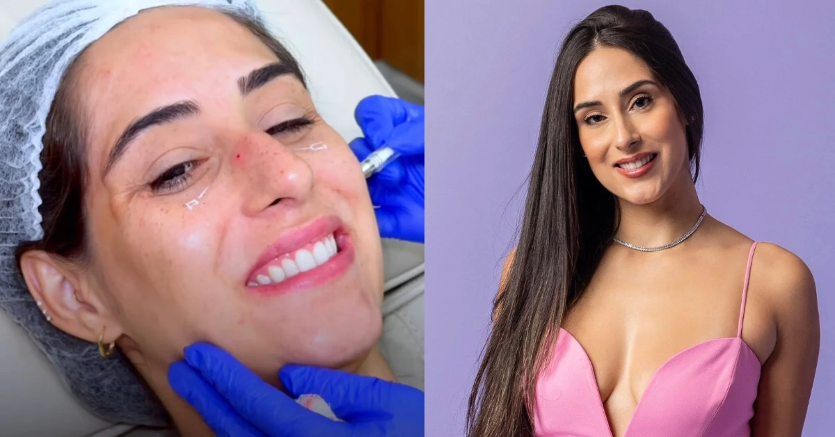 Após ser eliminada, Deniziane surpreende com harmonização facial - Fotos: Reprodução/Instagram/gshow