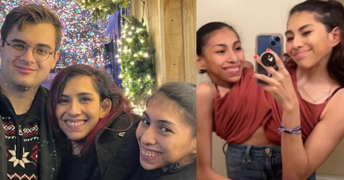 Gêmeas siamesas compartilham rotina e detalham vida íntima após uma assumir namoro - Fotos: Reprodução/Instagram