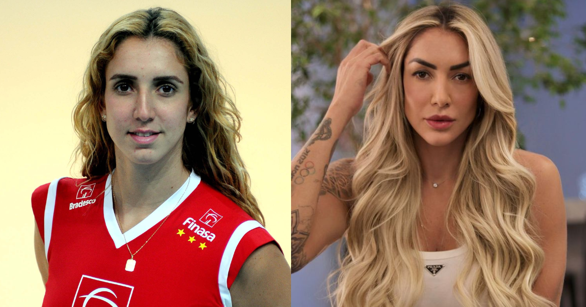 Irreconhecível! Veja antes e depois de Thaisa Daher após cirurgias plásticas