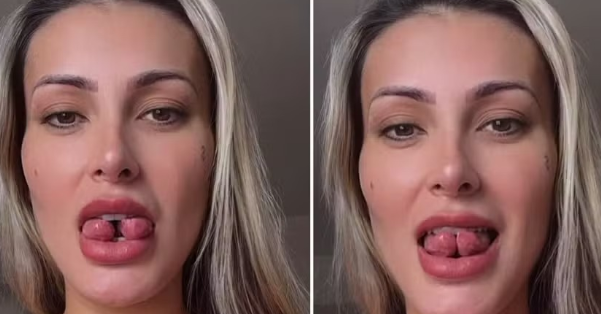 Andressa Urach revela qual foi o real motivo que a incentivou a realizar a cirurgia na língua; confira