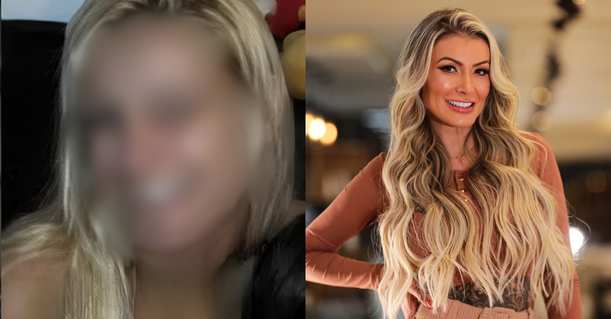 Andressa Urach: Antes e depois - Foto: Reprodução