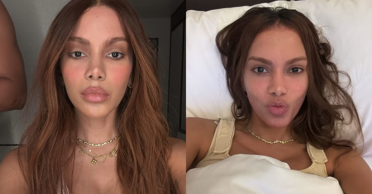 Equipe de Anitta se manifesta após rumores de “novo rosto” da artista