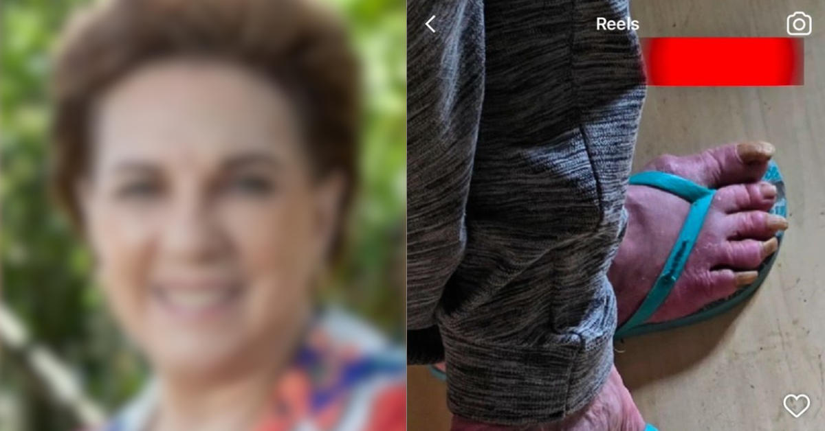 Ex-atriz da Globo é encontrada em condições sub-humanas - Foto: Reprodução